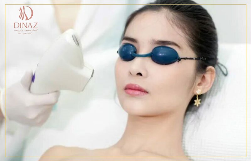 لزوم استفاده از محافظ چشم برای لیزر درمانی 
