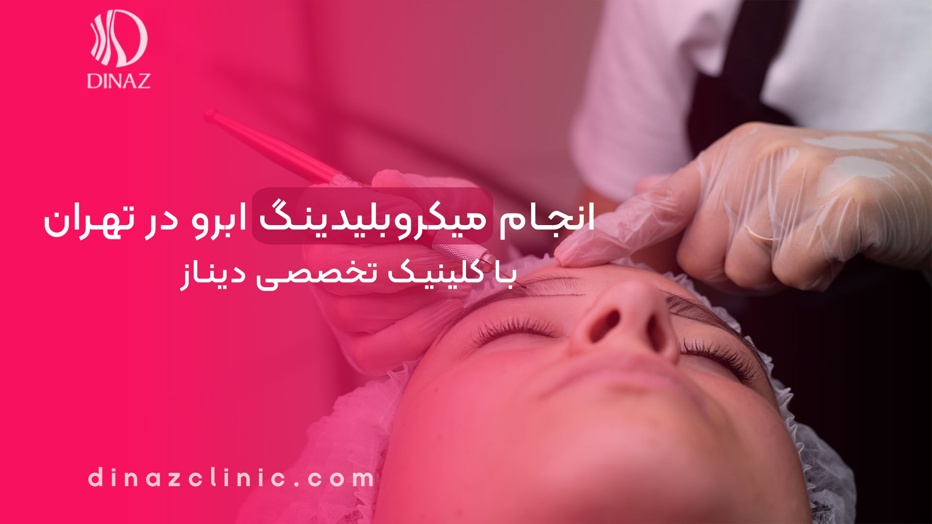 انجام میکروبلیدینگ ابرو در تهران (❤️کلینیک دیناز)