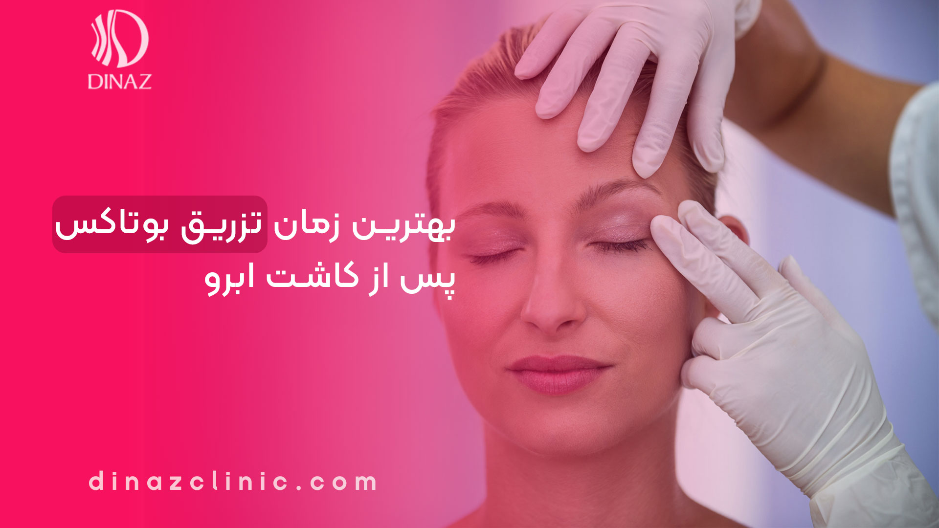 بهترین زمان تزریق بوتاکس پس از کاشت ابرو