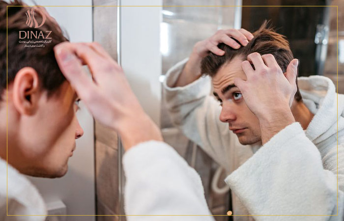 مردی موهای سرش را در آینه بررسی می کند تا نکات قبل از کاشت مو را رعایت کرده باشد